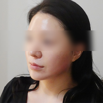 After