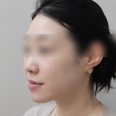 After