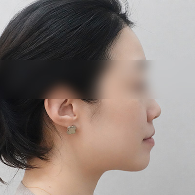 After