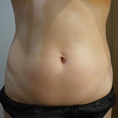 After